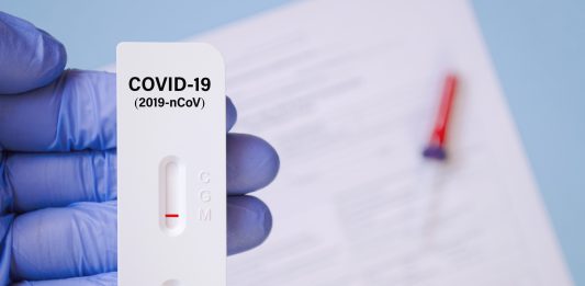 L’Ajuntament de Cornellà ofereix a la Generalitat espais i personal per poder realitzar tests rèpids d’antígens